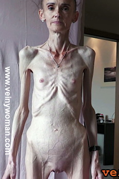 bild5